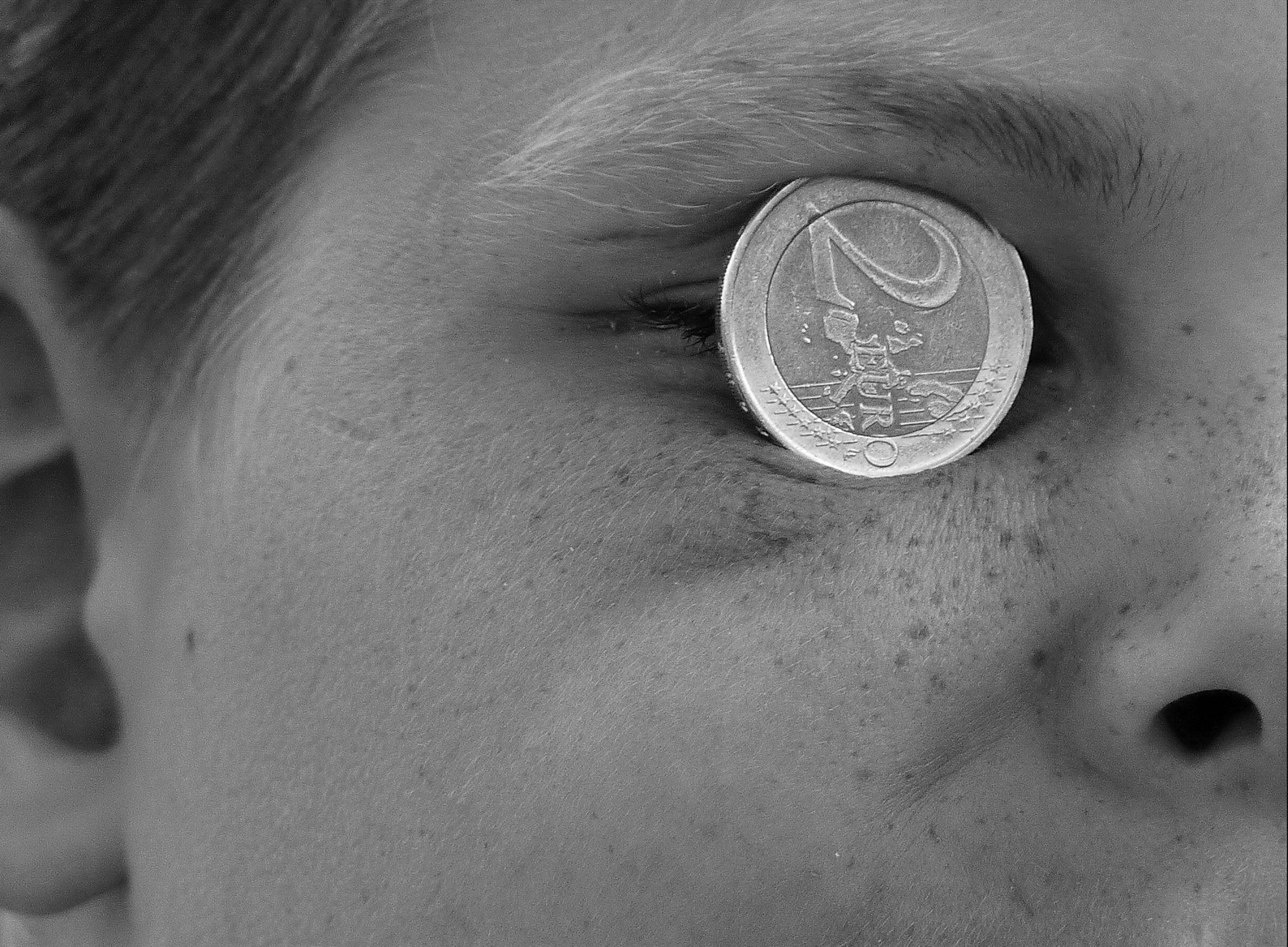 Foto: Man sieht den Teil eines Gesichtes. Im rechten Auge steckt eine 2-Euro-Münze.